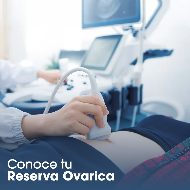Reserva ovarica 2